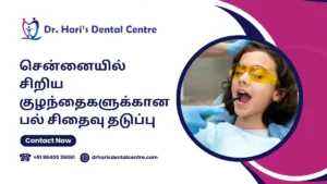 சென்னையில் சிறிய குழந்தைகளுக்கான பல் சிதைவு தடுப்பு