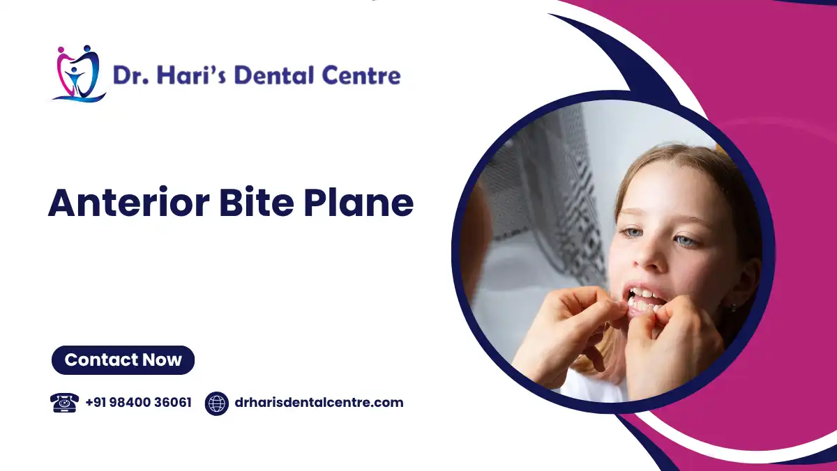 Anterior Bite Plane