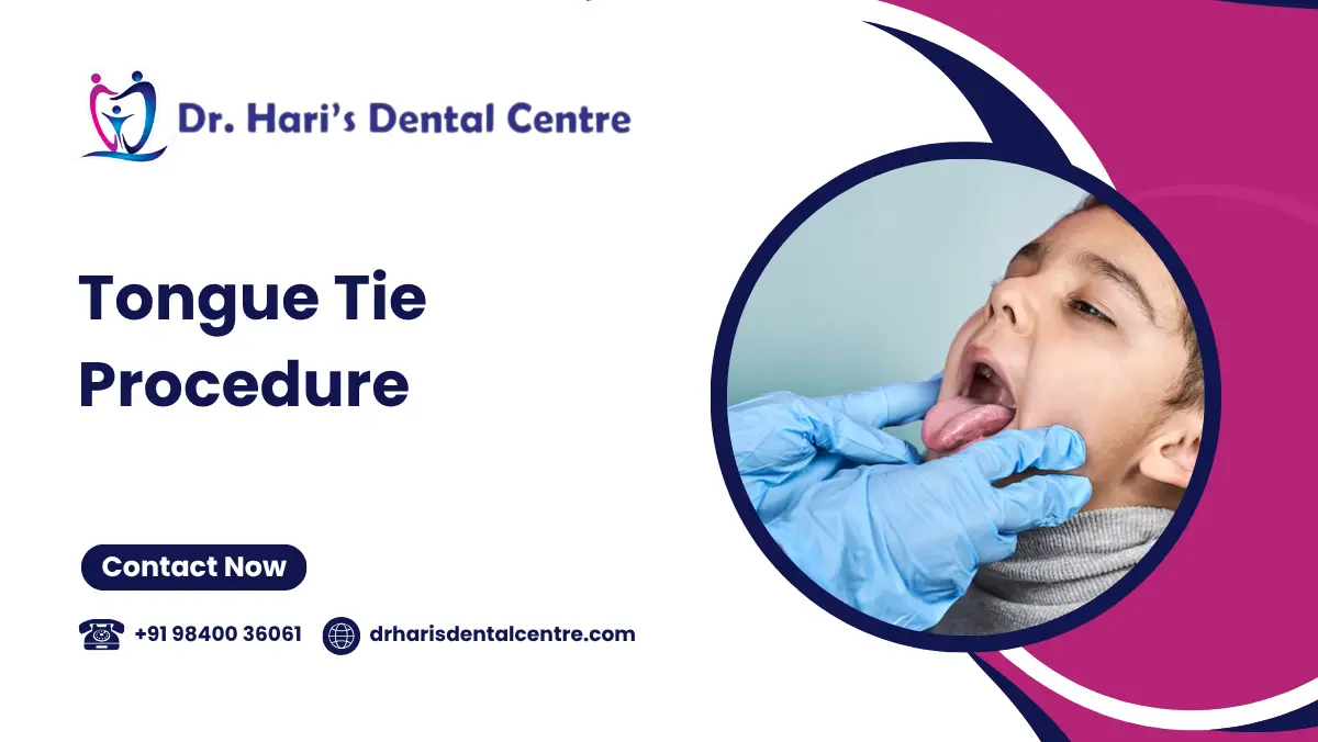 Tongue-Tie Procedure 