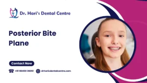 Posterior Bite Plane