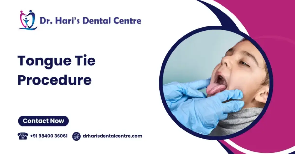 Tongue-Tie Procedure 