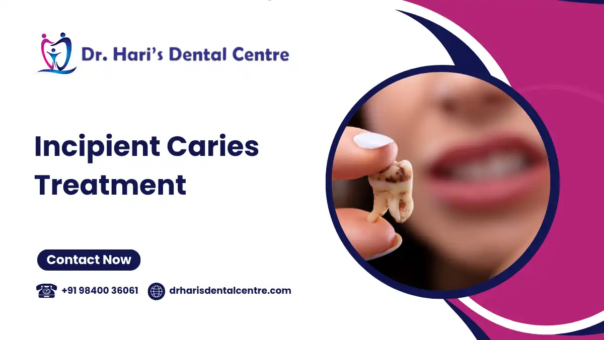 Incipient Caries Treatment