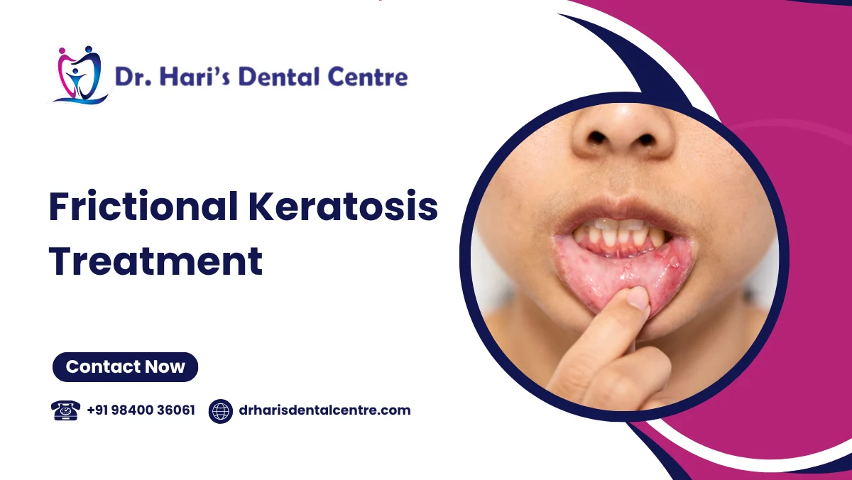 Frictional Keratosis Treatment