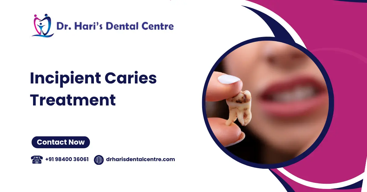 Incipient Caries Treatment