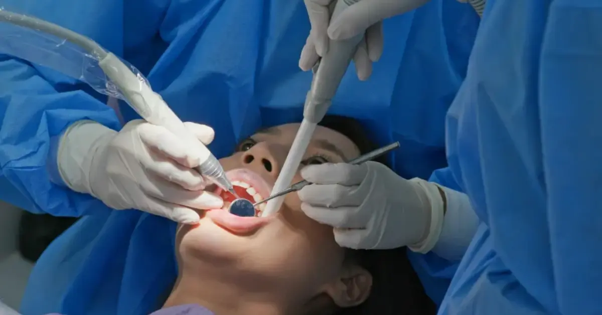 Teeth Scaling and Cleaning