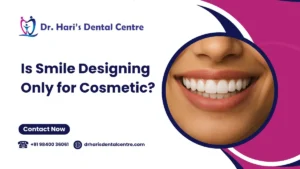 Smile designing