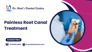 painless root canal treatment