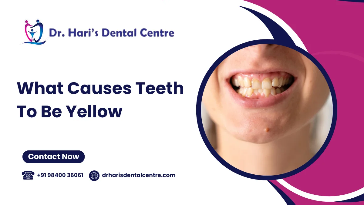 what causes teeth to be yellow